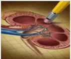 agenda Pathophysiology Hyperphoshatemia and CVD risk Phoshate diet in CKD