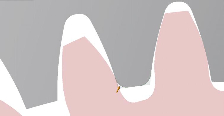 οδόντωσης, το πινιόν (ο μικρός τροχός) θα έχει την εξωτερική οδόντωση και θα βρίσκεται πάντα στο εσωτερικό του συνεργαζόμενου οδοντωτού τροχού ο οποίος θα έχει εσωτερική οδόντωση.