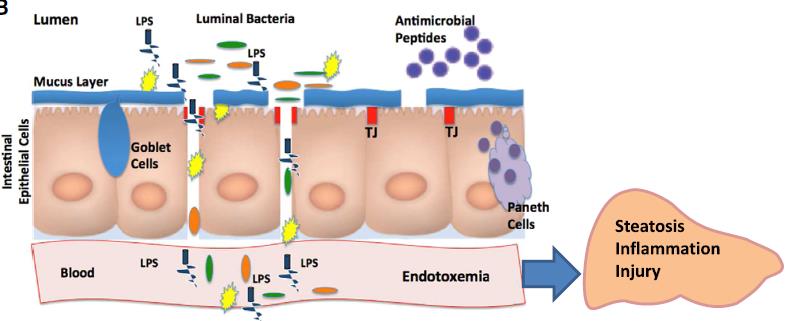 Liver gut axis Παθογένεια Διαταραχές στη