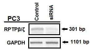 Στη συνέχεια πραγματοποιήθηκε RT-PCR με εναρκτήριες αλληλουχίες ειδικά σχεδιασμένες έναντι του RPTPβ/ζ, τα προϊόντα των οποίων ηλεκτροφορήθηκαν σε πήκτωμα αγαρόζης.