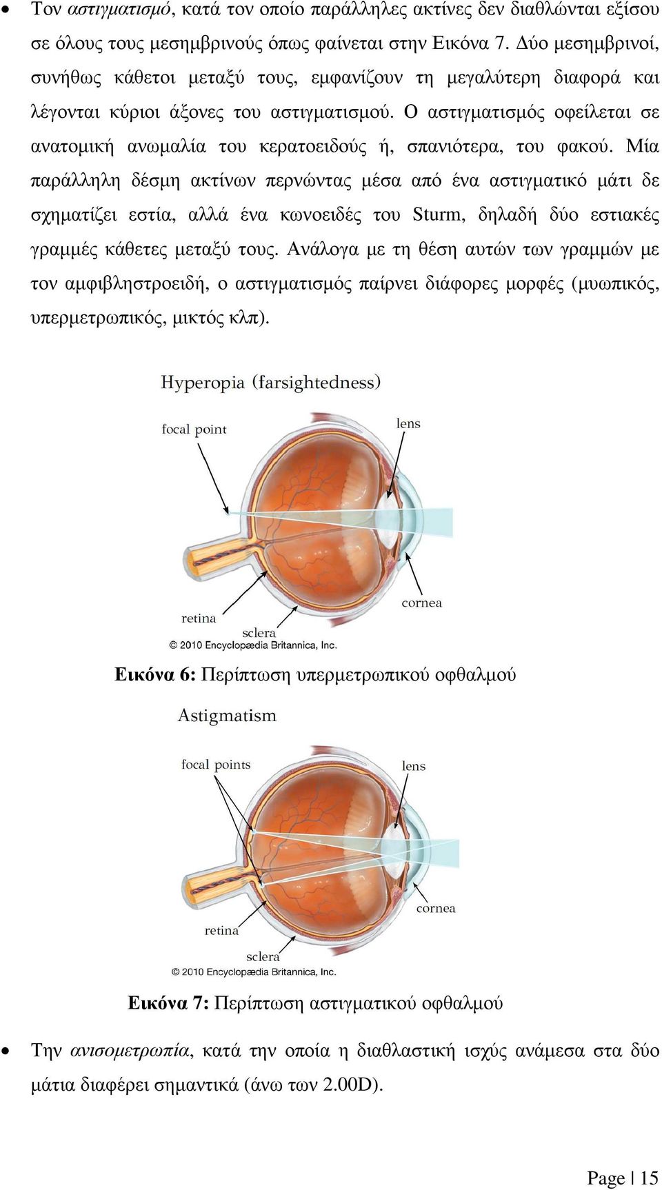 Ο αστιγµατισµός οφείλεται σε ανατοµική ανωµαλία του κερατοειδούς ή, σπανιότερα, του φακού.