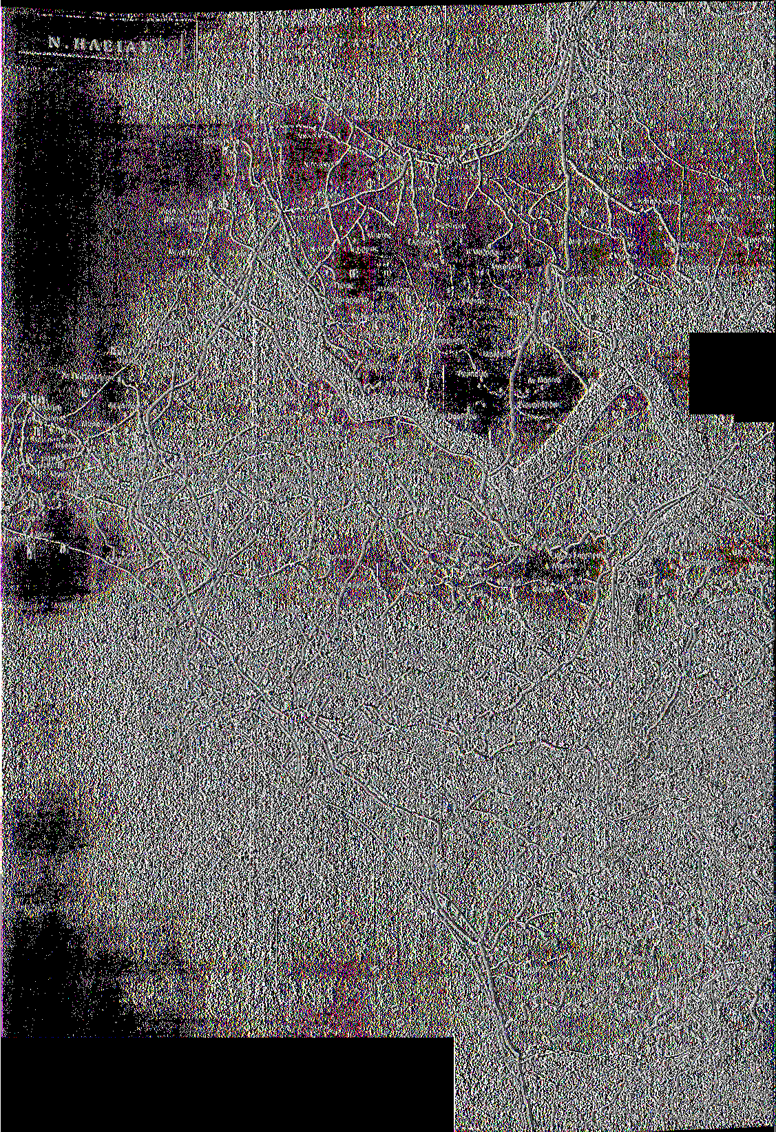 ι^ ί ίχ Κ Ε ν Α - 5... φ π Π Α Τ Ρ Α Κ 0 Κ Ο Λ Π Ο Ι Σ λ;μλο3α>λςςα μ Λ *: 01 ΧΓΜ νο * ί ϊ» Παραλιρ Θ '.ΟΗΕ γ Ν& Μοι*οο Γ' ί>κ. π Γ ι> Καλαμοκίου Μονοίονίρι ΐλ-ΜΟτο Κθυ'ΛΧ ΠέΛ\ΐ μοχικι.' Μπϋ»ν < Πγ.