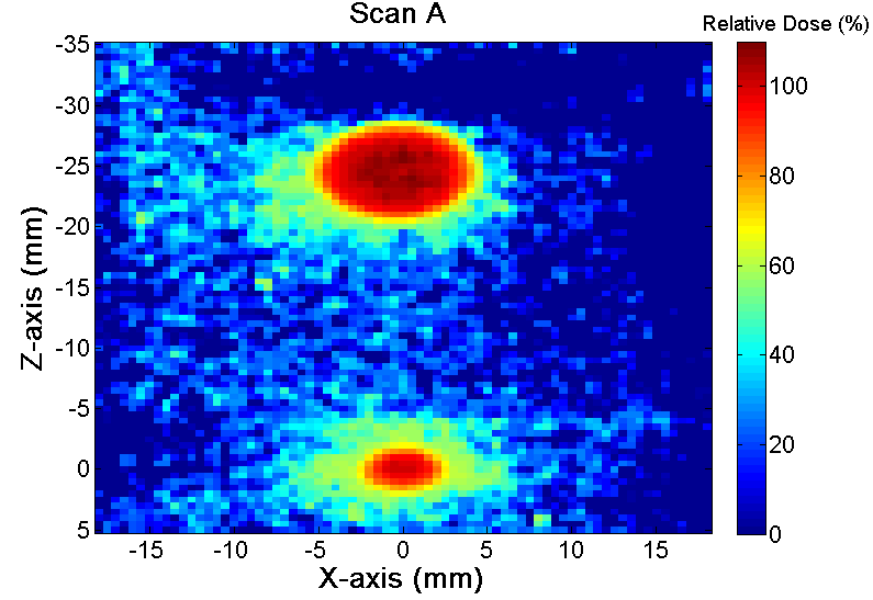 Χημική δοσιμετρία πολυμερισμού με ΑΜΣ (Polymer gel / MRI dosimetry) Τα δοσίμετρα γέλης αποτελούνται από κατάλληλα μονομερή, διεσπαρμένα σε υδατικό διάλυμα γέλης (gel) Με