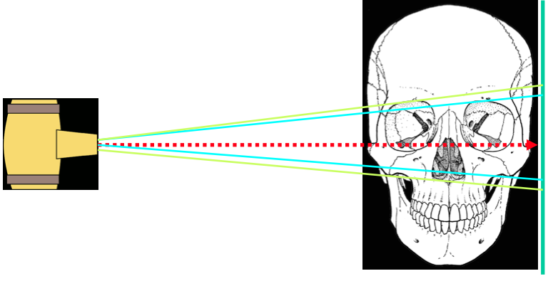 Μεγέθυνση Πλάγια Κεφαλομετρική Η ακτινική δέσμη αποκλίνει καθώς απομακρύνεται από την πηγή ακτινοβόλησης αυτό προκαλεί διαφορετικού