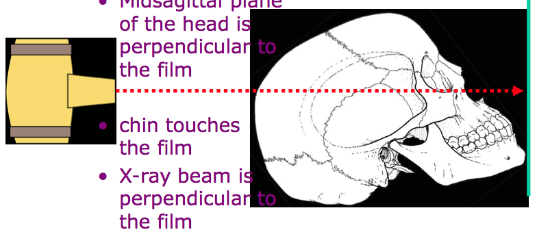 Πωγωνορρινική (ινογενειακή) προβολή 45 ο (Water s) Τοποθέτηση ασθενή: Η κεντρική ακτίνα κάθετη στο film Σημέιο επικέντρωσης