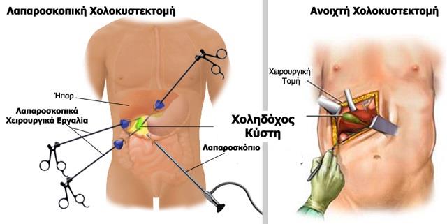 έχει διαβάσει ανώνυμες ιατρικές σημειώσεις και άλλα δεδομένα για περίπου 200.000 καρκινοπαθείς.