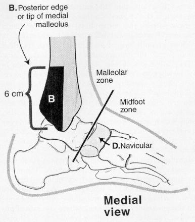 Πρωτόκολλο για τη χρήση ακτινογραφιών Ottawa Ankle Rules Ευαισθησία σε έκταση