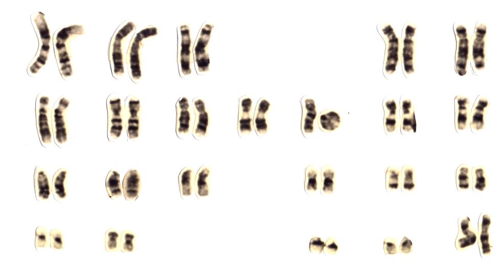 cytogenetics ΚΥΤΤΑΡΟΓΕΝΕΤΙΚΗ - PDF Free Download