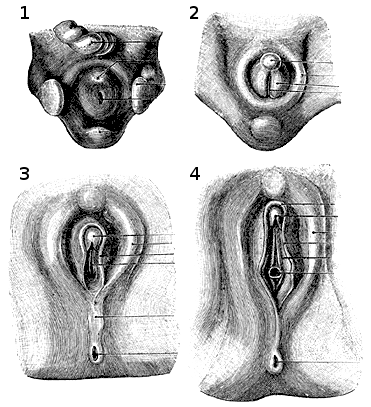 Έξω γεννητικά όργανα-2 Ωοθήκη (απουσία ανδρογόνων) Οιστρογόνα (πηγές: μητέρα και πλακούντας) Paramesonephric duct stimulation (fallopian tube, uterus, upper vagina) External genitalia