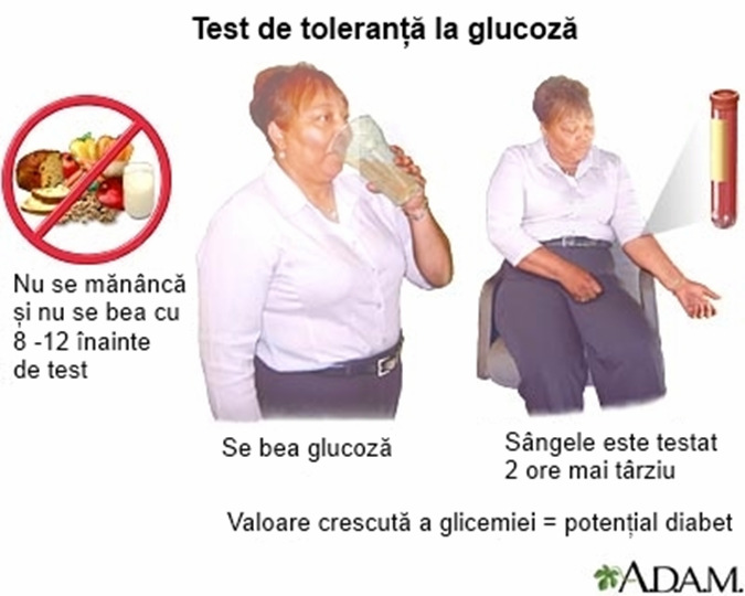 Figura nr.2 Etapele efectuării testului de toleranţă la glucoză. Figura nr. 3.