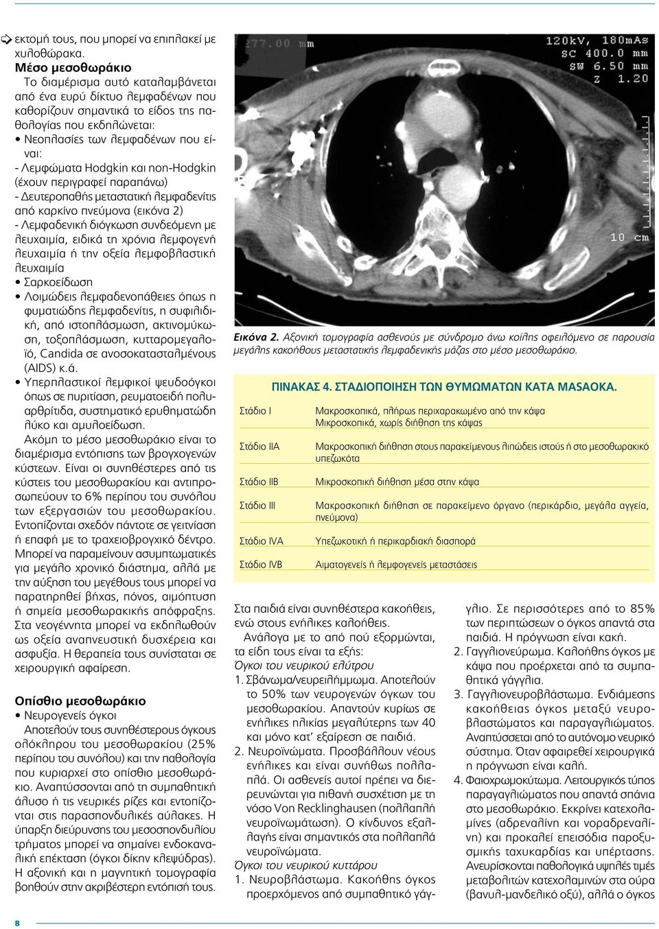 Hodgkin και non-hodgkin (έχουν περιγραφεί παραπάνω) - Δευτεροπαθής μεταστατική λεμφαδενίτις από καρκίνο πνεύμονα (εικόνα 2) - Λεμφαδενική διόγκωση συνδεόμενη με λευχαιμία, ειδικά τη χρόνια λεμφογενή