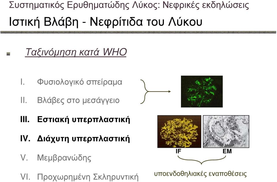 III. Βλάβες στο µεσάγγειο Εστιακή υπερπλαστική IV.