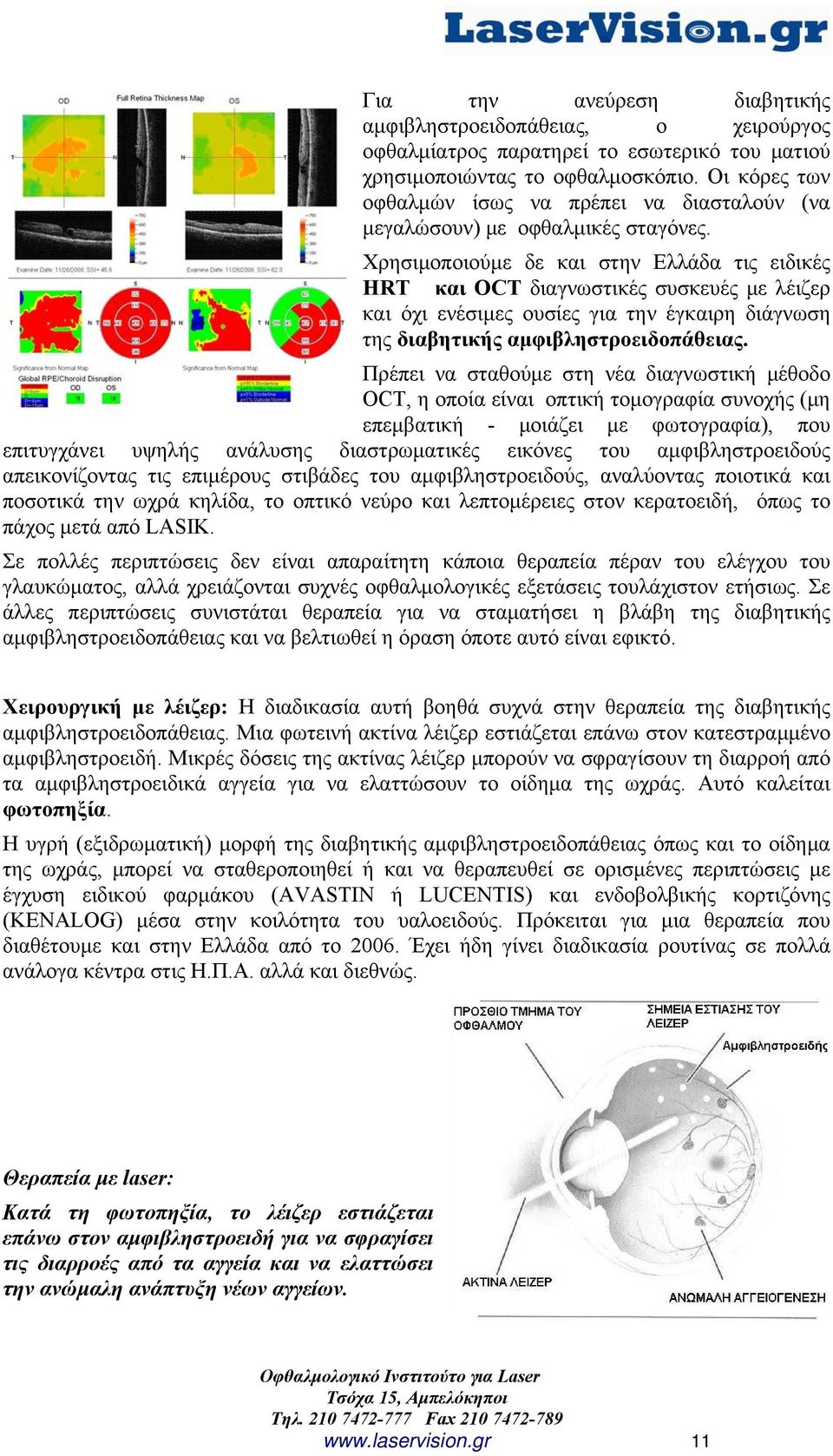 Xρησιμοποιoύμε δε και στην Ελλάδα τις ειδικές ΗRΤ και OCT διαγνωστικές συσκευές με λέιζερ και όχι ενέσιμες ουσίες για την έγκαιρη διάγνωση της διαβητικής αμφιβληστροειδοπάθειας.