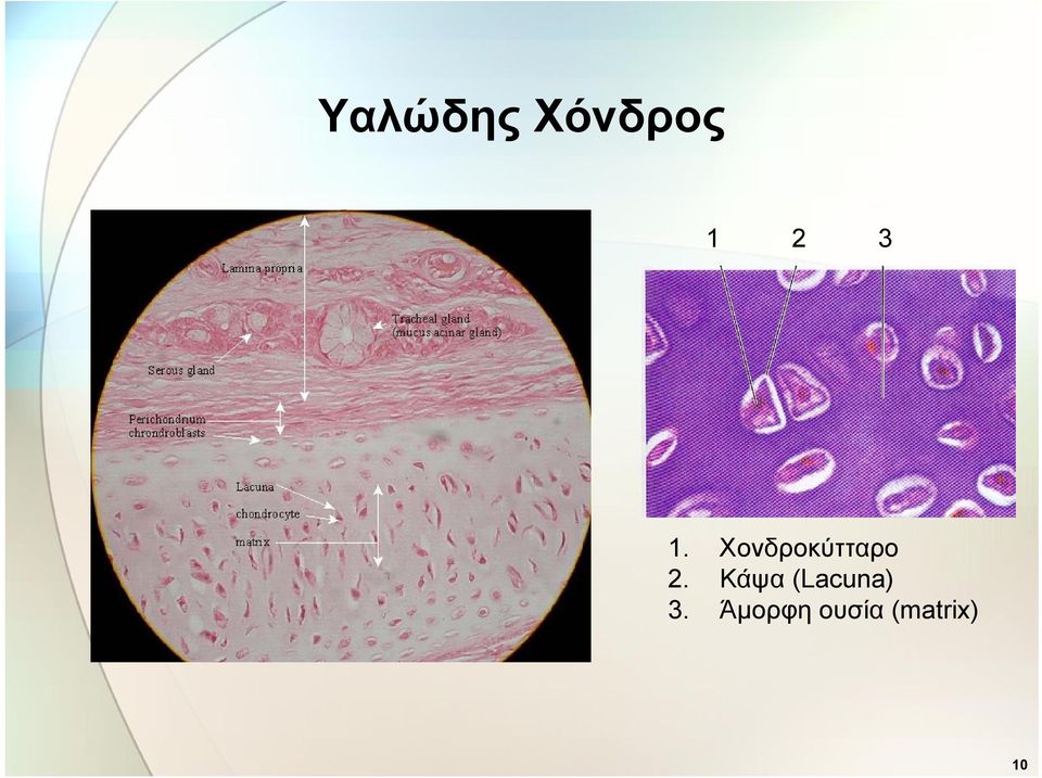 Κάψα (Lacuna) 3.