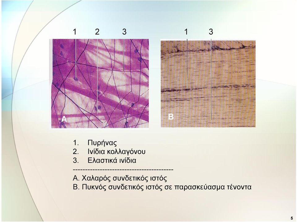 Ελαστικά ινίδια