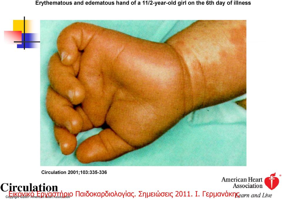 illness Circulation 2001;103:335-336