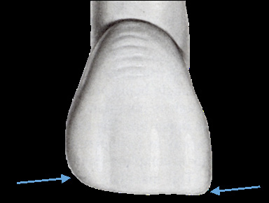 Εικόνα 2.16: Γωνίες, (κεντρικός τομέας άνω γνάθου).4 14. Ακρορρίζιο, (apex). Το τελικό τμήμα της ρίζας του δοντιού (Εικ.2.17). Εικόνα 2.17: Ακρορρίζιο και διχασμός ριζών. 15.