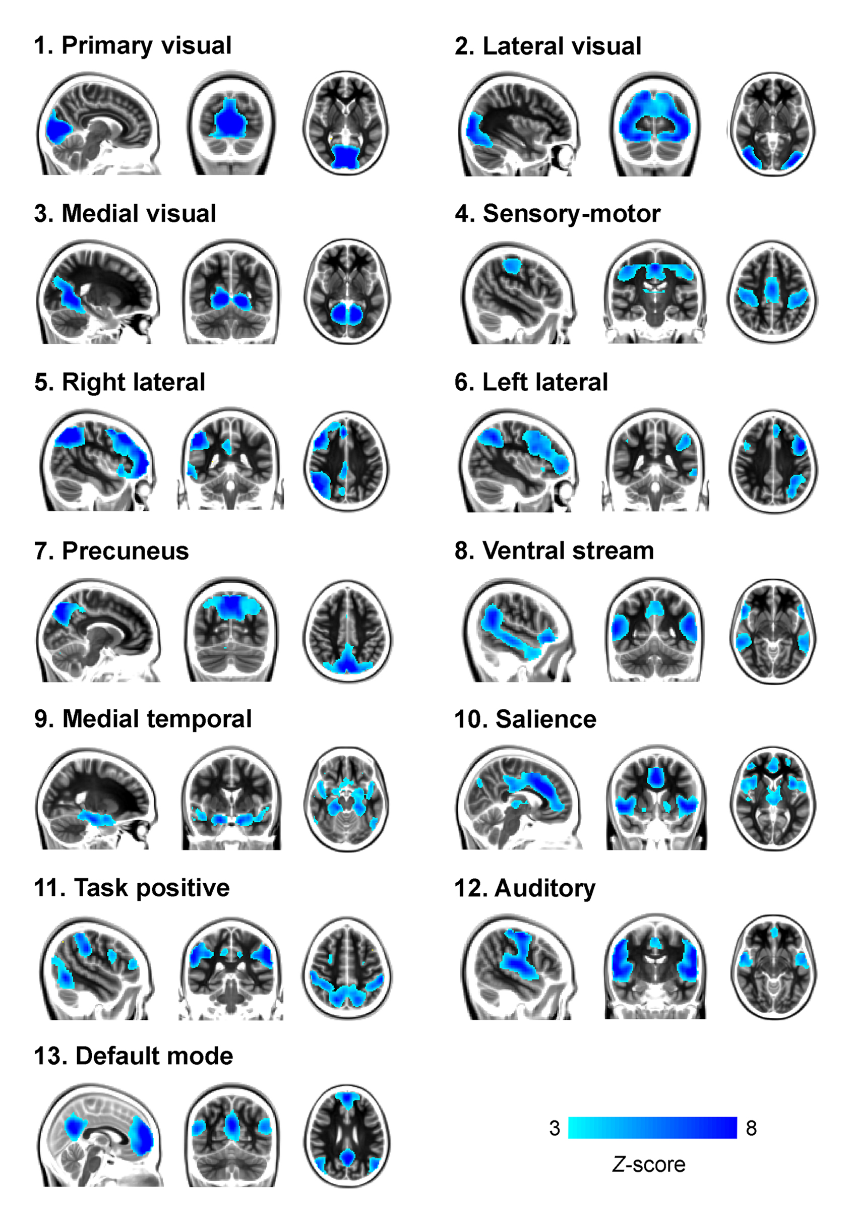 Εικόνα 12 : Τα κυριότερα δίκτυα ηρεμίας που εμφανίζονται σσε διάφορες μελέτες resting-state fmri : [1] Πρωτογενές Οπτικό (primary visual), [2] Πλάγιο Οπτικό(lateral visual), [3] Μεσαίο Οπτικό (medial