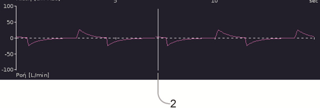 κυματομορφών εμφανίζει τα τελευταία 15 δευτερόλεπτα της πίεσης και της ροής του αεραγωγού του ασθενούς σε γράφημα. Το γράφημα ενημερώνεται σε πραγματικό χρόνο.