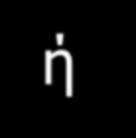 Παράγοντες εξέλιξης από IFG και IGT σε ΣΔ2 ADDITION study, n:1821 με IFG ή