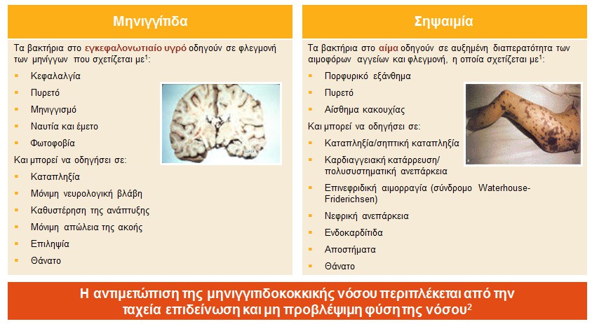 Η μηνιγγιτιδοκοκκική νόσος μπορεί να οδηγήσει σε μηνιγγίτιδα ή