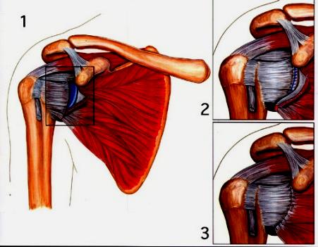 ΜΥΣ Οι μύες είναι όργανα του ανθρωπίνου σώματος.