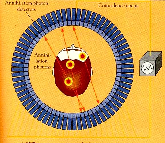 Τομογραφία Ποζιτρονιακής Εκπομπής (Positron Emission Tomography -PET) Ισότοπα εκπομπής ποζιτρονίων 11 C, 15 O, 13 N, 18 F, 68