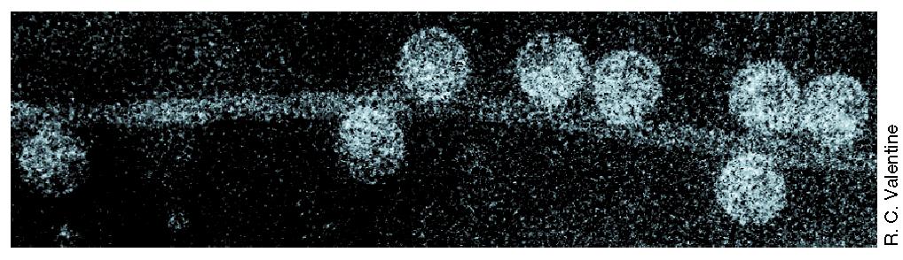 1: Ηλεκτρονιακό μικρογράφημα του τριχιδίου ενός βακτηριακού