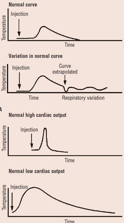 Σχεδιάγραμμα 6: μεταβολές της καμπύλης θερμοαραίωσης ανάλογα με την καρδιακή παροχή.