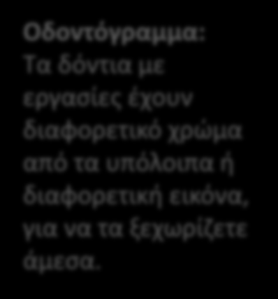 Οδοντόγραμμα: Τα δόντια με εργασίες έχουν διαφορετικό χρώμα από τα υπόλοιπα ή διαφορετική εικόνα, για να τα ξεχωρίζετε άμεσα.