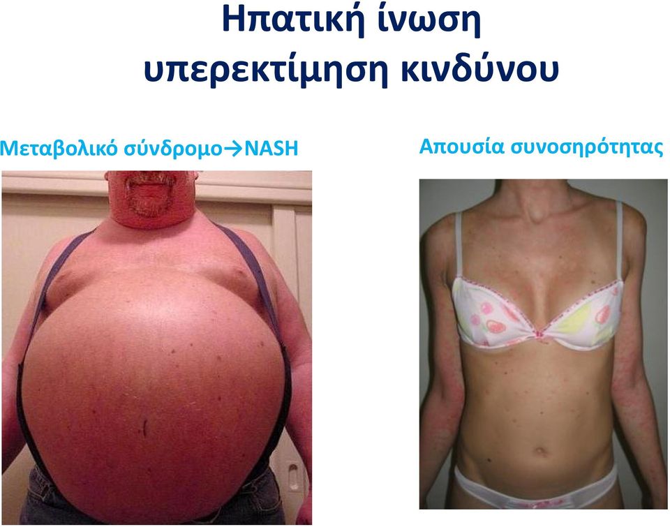 κινδύνου Μεταβολικό