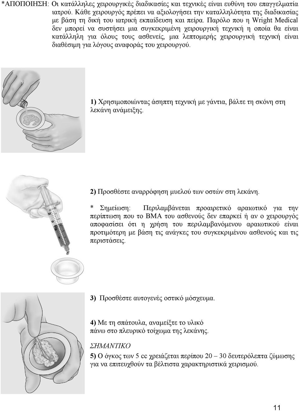 Παρόλο που η Wright Medical δεν μπορεί να συστήσει μια συγκεκριμένη χειρουργική τεχνική η οποία θα είναι κατάλληλη για όλους τους ασθενείς, μια λεπτομερής χειρουργική τεχνική είναι διαθέσιμη για