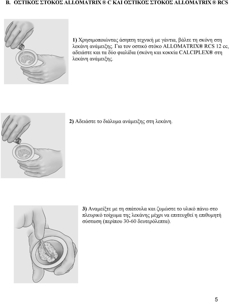 Για τον οστικό στόκο ALLOMATRIX RCS 12 cc, αδειάστε και τα δύο φιαλίδια (σκόνη και κοκκία CALCIPLEX στη λεκάνη