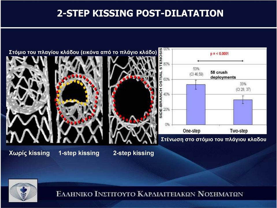 κλάδο) Χωρίς kissing 1-step kissing