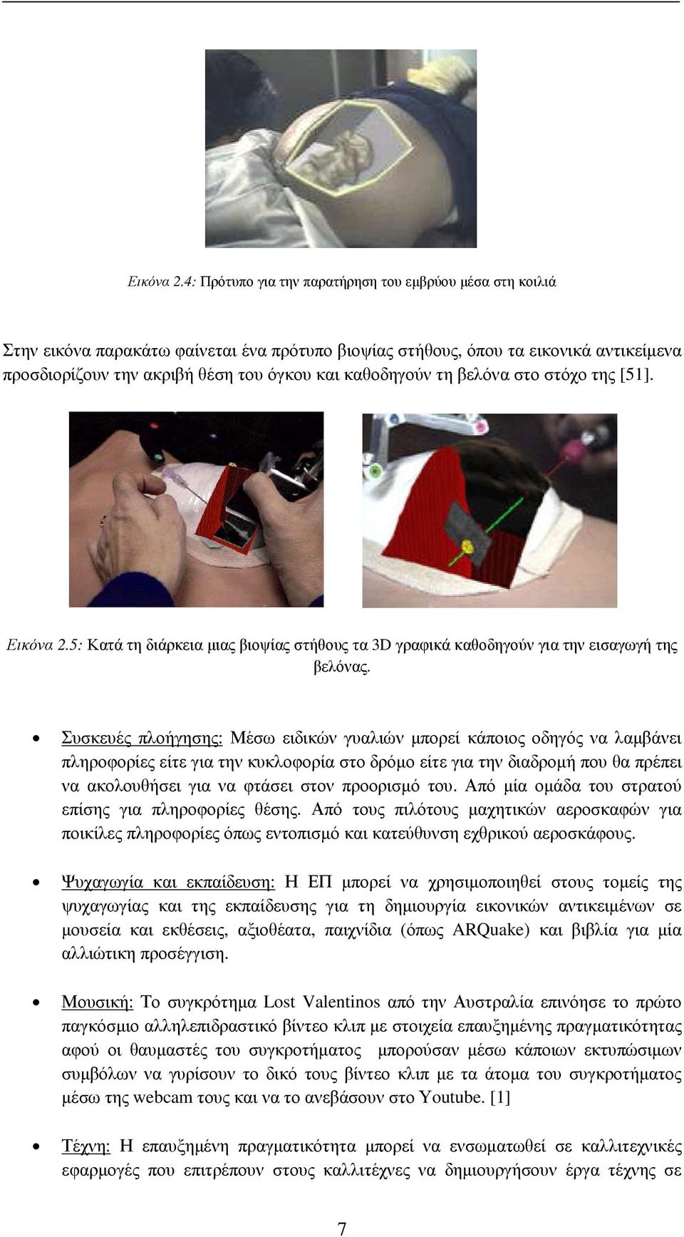 καθοδηγούν τη βελόνα στο στόχο της [51]. 5: Κατά τη διάρκεια µιας βιοψίας στήθους τα 3D γραφικά καθοδηγούν για την εισαγωγή της βελόνας.