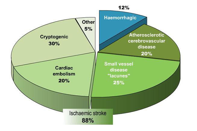Αιτιολογία Adams et al, Stroke