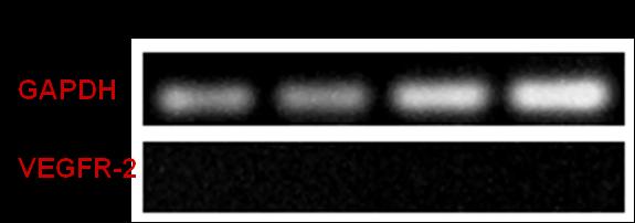 Εικόνα 47: Αποτελέσματα RT-PCR ανάλυσης, για τα γονίδια GAPDH και VEGFR- 2.