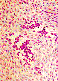 Cytopathic