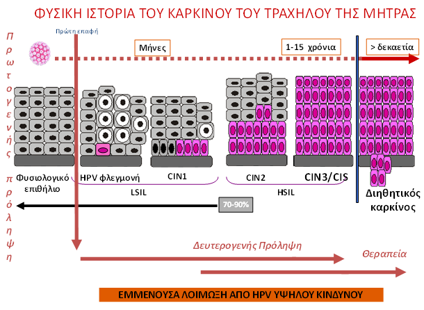 πενταετής επιβίωση 69%. Παραμήτρια ελεύθερα νόσου θα ανεβάσουν την επιβίωση στο 95%.