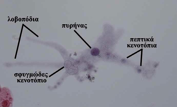 ΚΛΑΔΟΣ: ΑΜΟΙΒΑΔΟΖΩΑ (ΑΜΟΙΒΑΔΕΣ) Αντιπρόσωπος: Amoeba proteus - H Ταξινόμηση δεν έχει ολοκληρωθεί Επικράτεια
