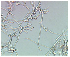 10 Να αναγνωρίστε το μικροοργανισμό από την παρακάτω λίστα Μοιάζει με Παραμήκιο Ευγλένα Δίμορφοι μύκητες σακχαρομύκητες Αμοιβάδα Νηματοειδείς μύκητες 11 Που οφείλεται ο έντονος αφρισμός στο διάλυμα