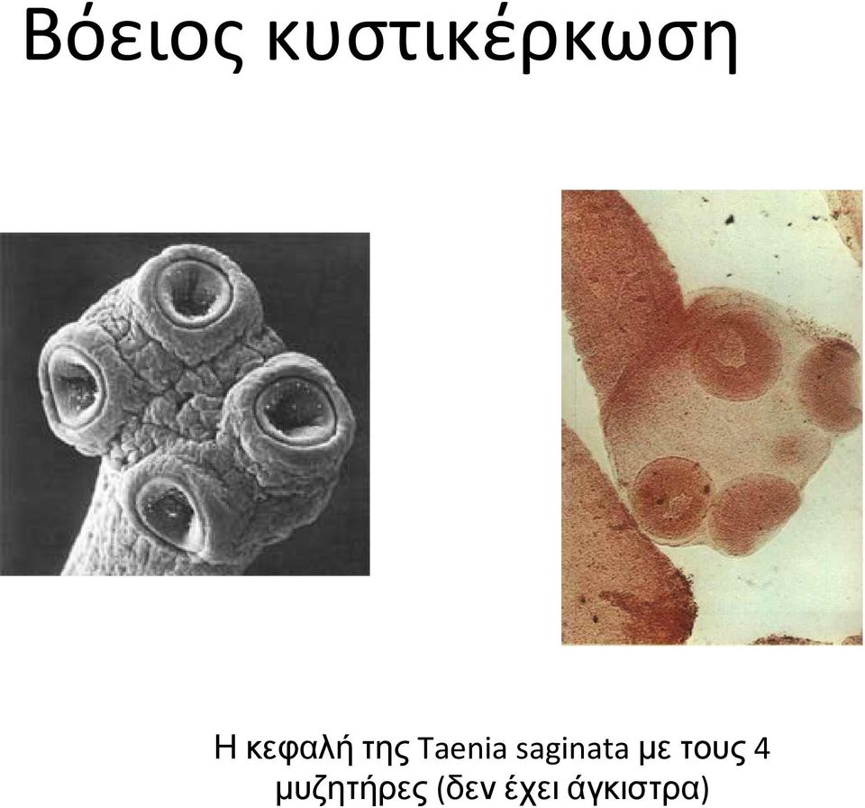 saginata με τους 4