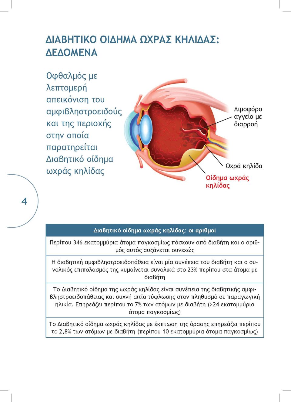 αμφιβληστροειδοπάθεια είναι μία συνέπεια του διαβήτη και ο συνολικός επιπολασμός της κυμαίνεται συνολικά στο 23% περίπου στα άτομα με διαβήτη Το Διαβητικό οίδημα της ωχράς κηλίδας είναι συνέπεια της