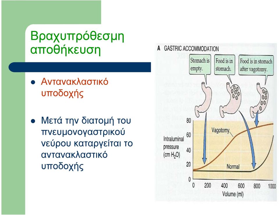 διατομή του πνευμονογαστρικού