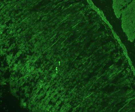 ΑΙΗ 1: SMA VGT PATTERN rat (liver-kidney-stomach)