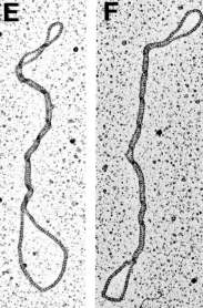 Borrelia
