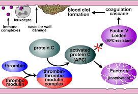 Factor V Leiden: