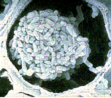 καρυδιών. Περιγραφή Το βακτήριο Χ.campestris pv. η Malvacearum, έχει την τυπική ραβδοειδή μορφή των βακτηρίων. Έχει μήκος 0,6-3,5 mm και διάμετρο 0,3-1,0 mm.