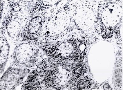komponente vezivne strome fibroblast hromofobne ćelije acidofilne ćelije Slika 2 Hipofiza - pars distalis (TEM) Pod elektronskim mikroskopom vrlo je teško razlikovati pojedine tipove ćelija