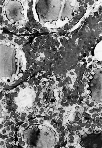 Slika 3 Tiroidna žlezda (SM, trojno bojenje) Ćelije folikularnog epitela najčešće su kockaste, ali mogu biti i pločaste ili cilindrične. Od čega to zavisi? Kakav je oblik tirocita na ovim snimcima?